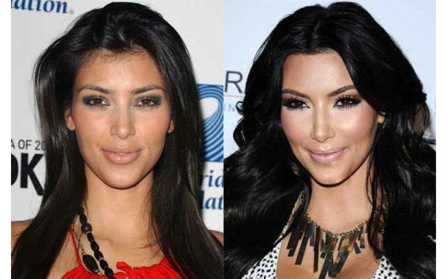 O rosto Kim Kardashian não foi sempre tão delineado