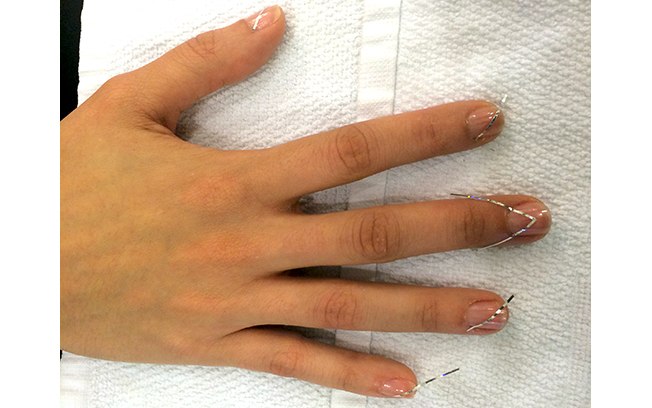 Apenas a unha do dedo médio tem um desenho diferente, como uma bandeirinha de festa junina. As outras unhas terão desenhos em diagonal, como triângulos
